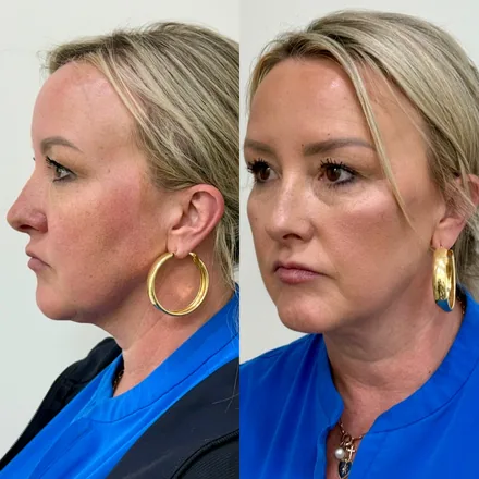 Facial Aesthetics